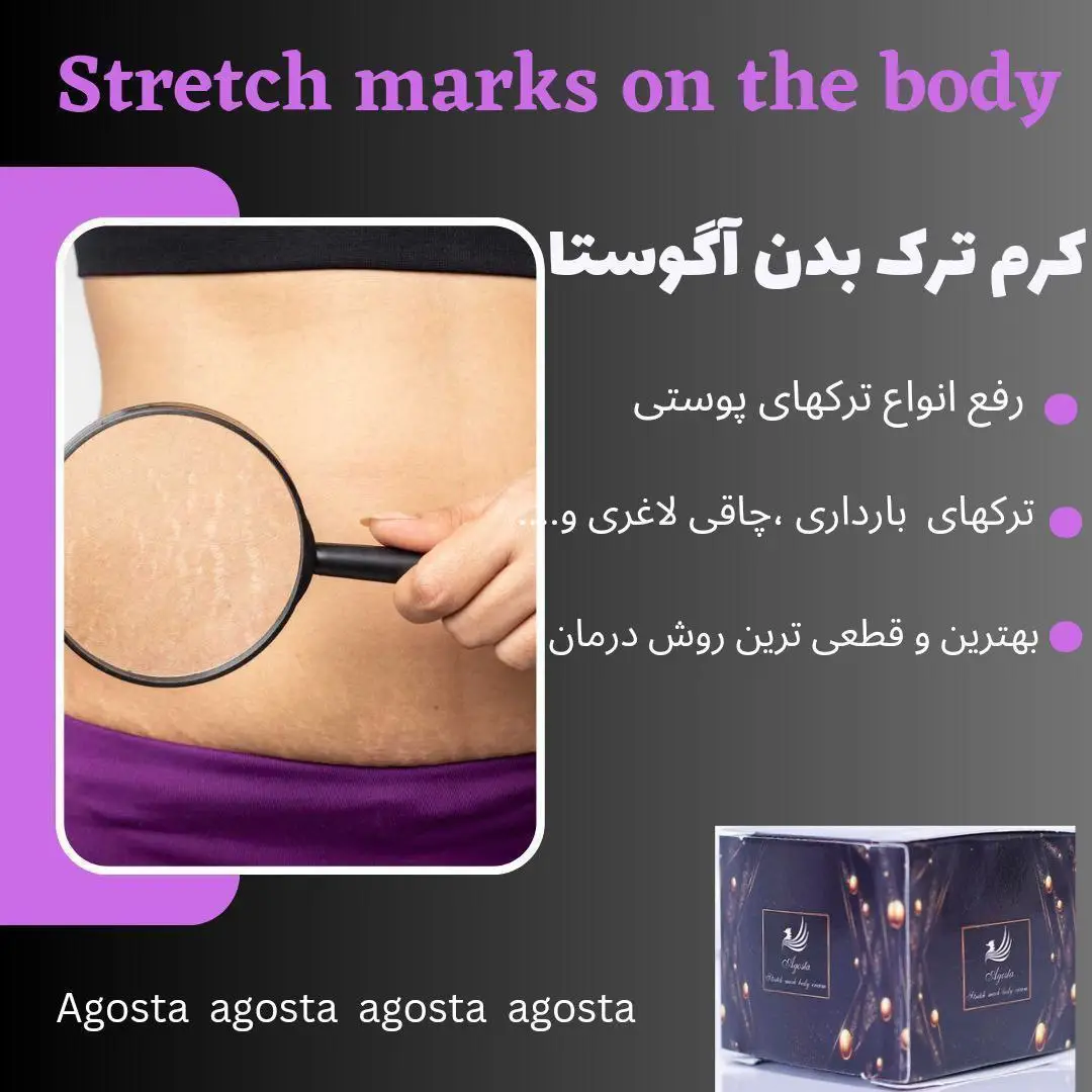 کرم آگوستا برای رفع ترک‌های پوست بدن و نرم و ترمیم کردن پوست
